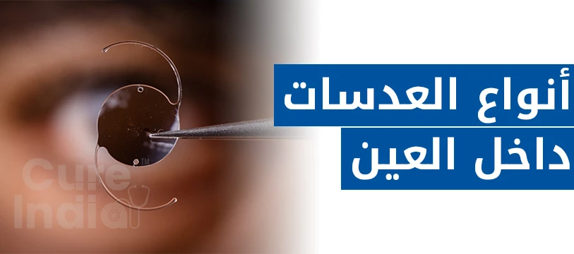 أفضل أنواع العدسات التي تزرع داخل العين في الهند